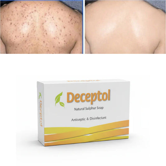Deceptol Sulphur Soap β Antiseptic Disinfectant Skin Care